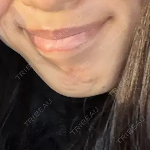 ビラビューティークリニック 博多美容外科/美容皮膚科 ビラビューティークリニック口コミ