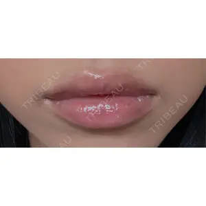 HAAB BEAUTY CLINIC 南青山本院（新院）口コミ