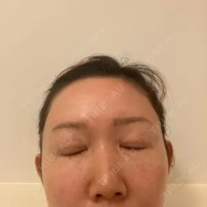 東京シルククリニック 東京シルククリニック 新宿院口コミ