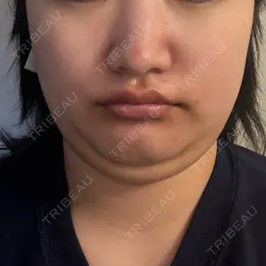 Nebula Clinic 新宿美容外科ネビュラクリニック口コミ