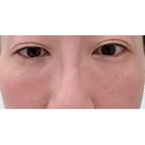 PRISM Beauty Clinic  PRISM Beauty Clinic 新宿院口コミ