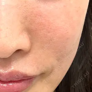 HAAB CLINIC HAAB×DREAM BEAUTY CLINIC 東京本院口コミ