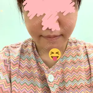 ウィーバー美容外科口コミ