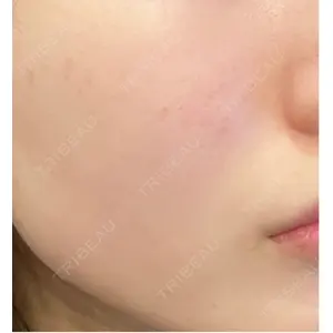 やさしい美容皮膚科・皮フ科 やさしい美容皮膚科・皮フ科　秋葉原院口コミ