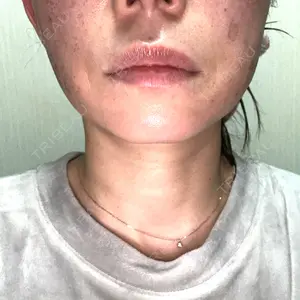 BITO BEAUTY CLINIC BITO BEAUTY CLINIC口コミ