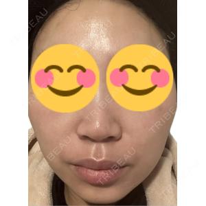 エルムクリニック 美容皮膚科エルムクリニック 麻布院口コミ