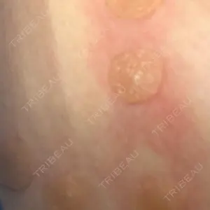 Fellez Clinic【フェルズクリニック】口コミ