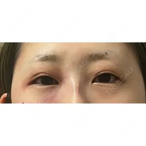 ルラ美容クリニック ルラ美容クリニック 宇都宮院口コミ