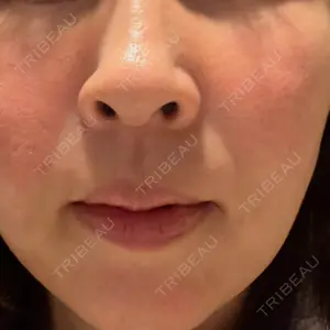 南青山コスメクリニック口コミ