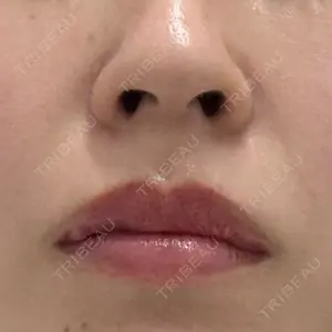 TCB東京中央美容外科 TCB東京中央美容外科 名古屋栄院口コミ