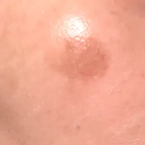 おおかみ美容のクリニック おおかみ美容のクリニック 横浜院口コミ