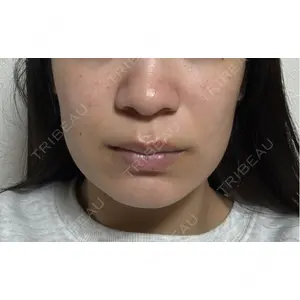 ルラ美容クリニック ルラ美容クリニック 宇都宮院口コミ