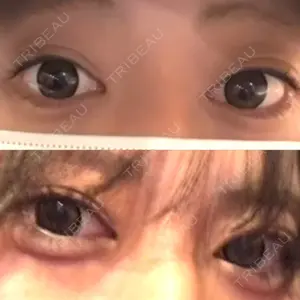 サラ美容外科口コミ