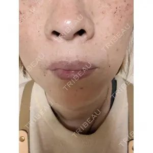 ルラ美容クリニック ルラ美容クリニック 仙台院 / ルラスキンクリニック 仙台院口コミ