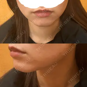 ビラビューティークリニック 博多美容外科/美容皮膚科 ビラビューティークリニック口コミ