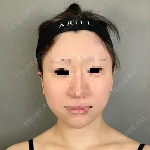 アリエル美容クリニック アリエル美容クリニック 大宮院口コミ