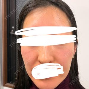 東京シルククリニック 東京シルククリニック 新宿院口コミ