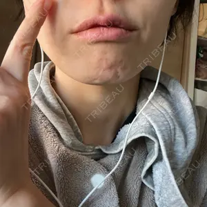 南青山コスメクリニック口コミ