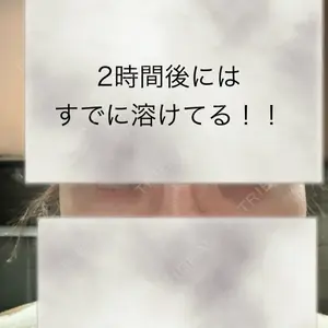 BITO BEAUTY CLINIC BITO BEAUTY CLINIC口コミ