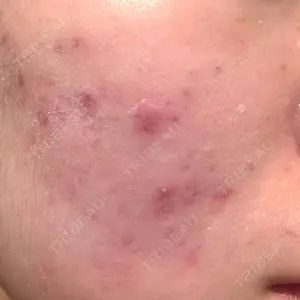 AURORA CLINIC（オーロラクリニック）新宿院口コミ