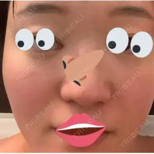 やさしい美容皮膚科・皮フ科 やさしい美容皮膚科・皮フ科　秋葉原院口コミ