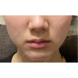 おおたかの森ビューティークリニック おおたかの森ビューティークリニック口コミ