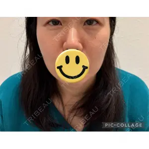 口コミ