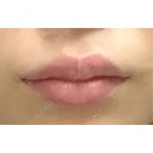 ビラビューティークリニック 博多美容外科/美容皮膚科 ビラビューティークリニック口コミ