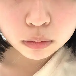 ルラ美容クリニック ルラ美容クリニック 大阪本院口コミ