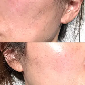 ヴェリテクリニック ヴェリテクリニック 名古屋院口コミ