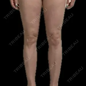 GAYA body design clinic口コミ