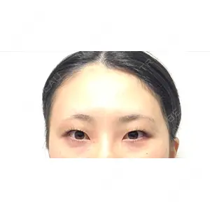 東京イセアクリニック口コミ