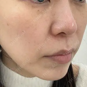 APスキンクリニック銀座口コミ