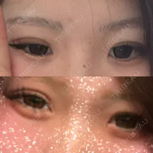 TCB東京中央美容外科 TCB東京中央美容外科 京都四条院口コミ
