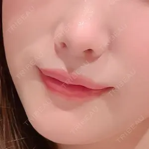 東京美容皮膚科アロエクリニック 東京美容皮膚科アロエクリニック池袋口コミ