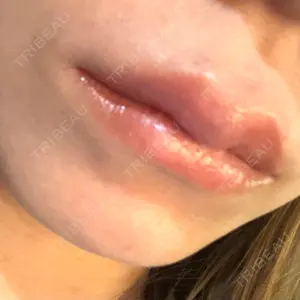 BiBiクリニック口コミ