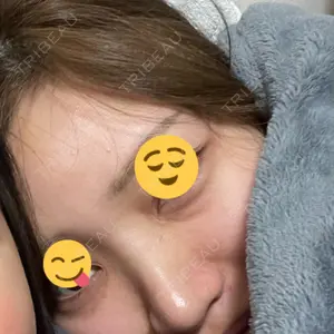 TCB東京中央美容外科 TCB東京中央美容外科 銀座有楽町院口コミ