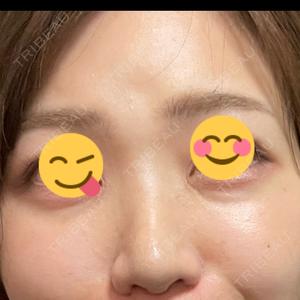 TCB東京中央美容外科 TCB東京中央美容外科 銀座有楽町院口コミ