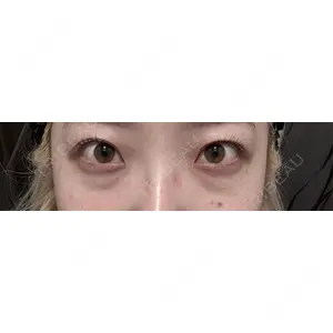 Nebula Clinic 新宿美容外科ネビュラクリニック口コミ