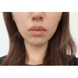 心斎橋なんばRINBEAUTYCLINIC美容皮膚科美容外科 RIN BEAUTY CLINIC口コミ