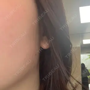 おおたかの森ビューティークリニック おおたかの森ビューティークリニック口コミ