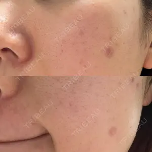 東京シルククリニック 東京シルククリニック 新宿院口コミ