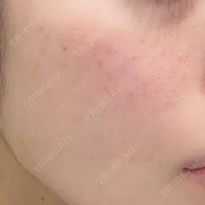 トラスト美容クリニック トラスト美容クリニック 銀座院口コミ