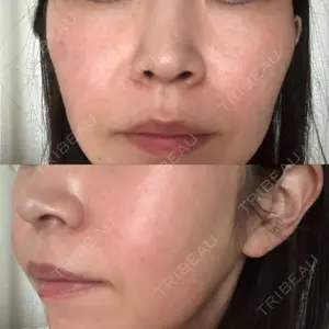 東京美容皮膚科アロエクリニック 東京美容皮膚科アロエクリニック池袋口コミ