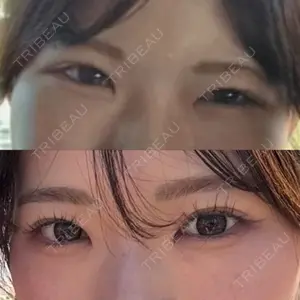プロクリニック PRO CLINIC プロクリニック 銀座院口コミ
