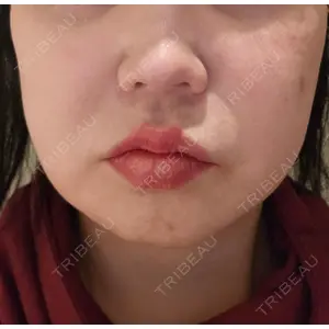 HAAB CLINIC HAAB×DREAM BEAUTY CLINIC 東京本院口コミ