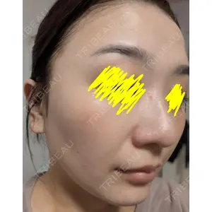 トラスト美容クリニック トラスト美容クリニック 銀座院口コミ