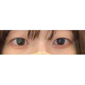 東京イセアクリニック口コミ