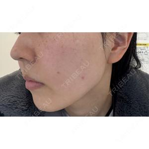 ルラ美容クリニック ルラ美容クリニック 静岡院口コミ