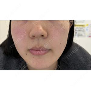 ルラ美容クリニック ルラ美容クリニック 静岡院口コミ